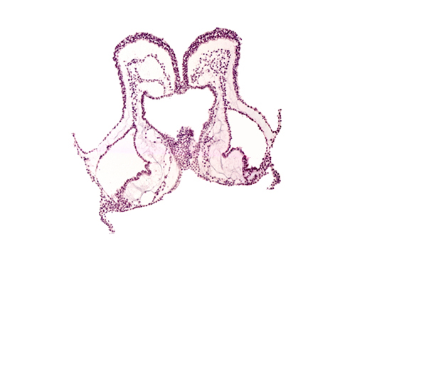 aortic arch 3, cephalic intestinal portal, head mesenchyme, hepatic plate endoderm, interventricular sulcus, mesencephalon primordium (M), primordial endocardium, primordial left dorsal aorta, primordial pericardial cavity