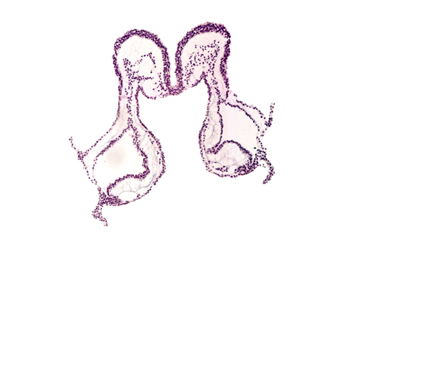 interventricular sulcus, mesencephalon primordium (M), midgut primordium (lumen), presumptive left ventricle, primordial neural crest (artifact separation), umbilical vesicle cavity