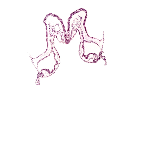 isthmus of rhombencephalon, midgut primordium (lumen), presumptive right atrium, primordial left dorsal aorta, primordial right dorsal aorta, rhombencephalon primordium (R), umbilical vesicle attachment