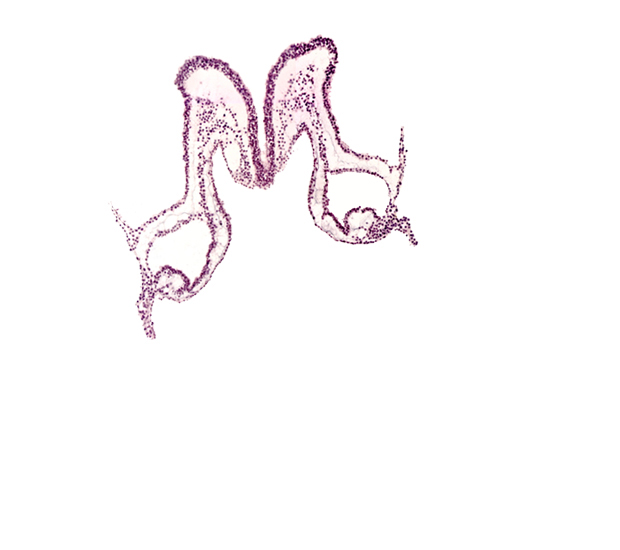 midgut primordium (lumen), presumptive left atrium, primordial left dorsal aorta, primordial right dorsal aorta, rhombencephalon primordium (R)