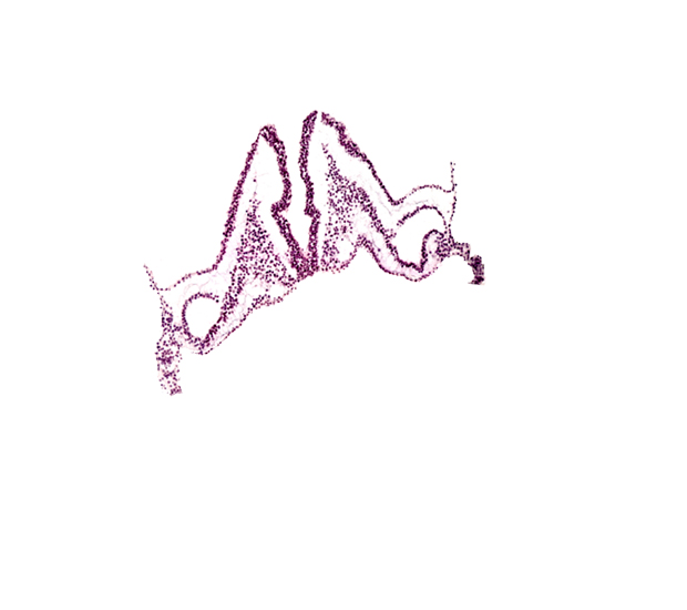 amniotic cavity, artifact separation(s), endoderm, extra-embryonic coelom, head mesenchyme, intra-embryonic coelom, left vitelline (omphalomesenteric) artery, notochordal plate, primordial left dorsal aorta, rhombomere B (Rh. B), rhombomere C (Rh. C), right vitelline (omphalomesenteric) artery, somatopleuric mesoderm, splanchnopleuric mesoderm, surface ectoderm, umbilical vesicle cavity