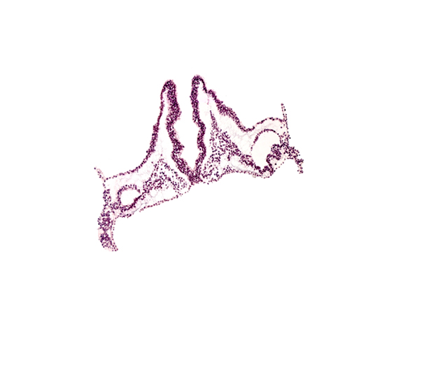 hemangioblastic tissue, midgut primordium (lumen), primordial otic placode, primordial right dorsal aorta, rhombomere A (Rh. A), rhombomere B (Rh. B), rhombomere C (Rh. C), right vitelline (omphalomesenteric) artery, right vitelline (omphalomesenteric) vein