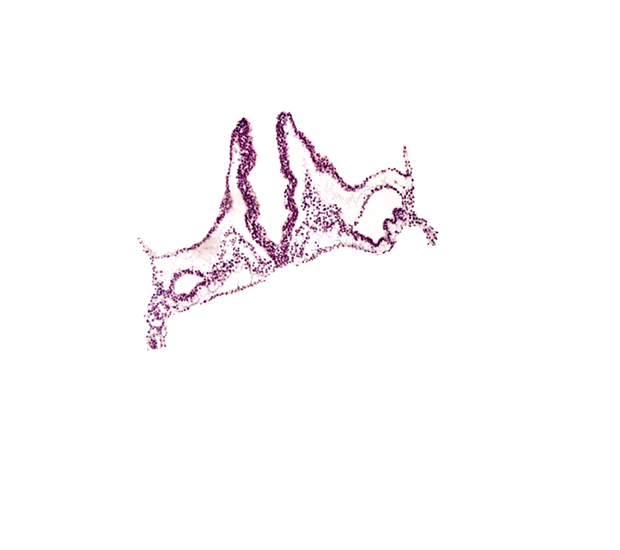 extra-embryonic mesoderm, head mesenchyme, hemangioblastic tissue, notochordal plate, primordial otic placode, primordial right dorsal aorta, rhombomere A (Rh. A), rhombomere B (Rh. B), rhombomere C (Rh. C)