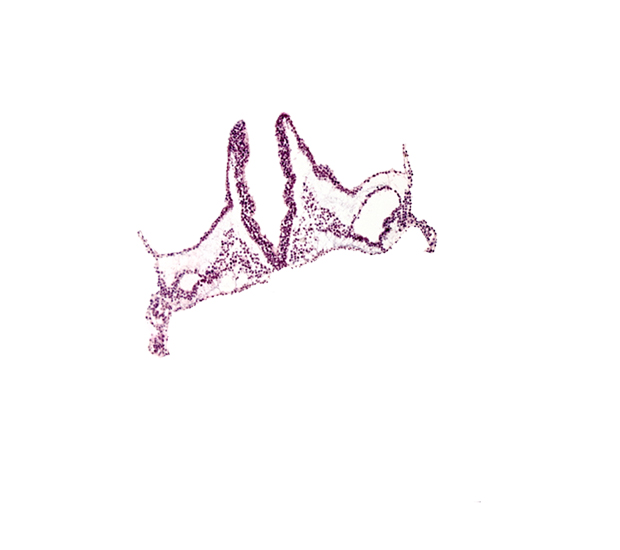 extra-embryonic mesoderm, head mesenchyme, left vitelline (omphalomesenteric) artery, primordial left dorsal aorta, primordial otic placode, rhombomere A (Rh. A), rhombomere B (Rh. B), rhombomere C (Rh. C)