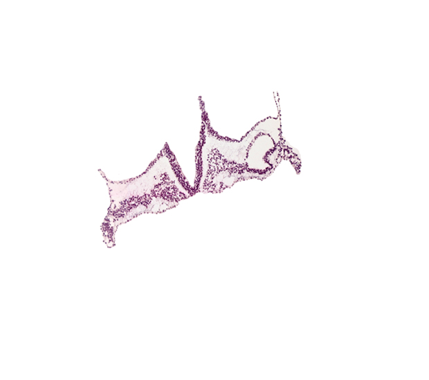 caudal edge of primordial otic placode, cephalic edge of somite 1 (O-1), intermediate mesenchyme, intra-embryonic coelom, rhombencephalon primordium (R), rhombomere B (Rh. B), rhombomere C (Rh. C)