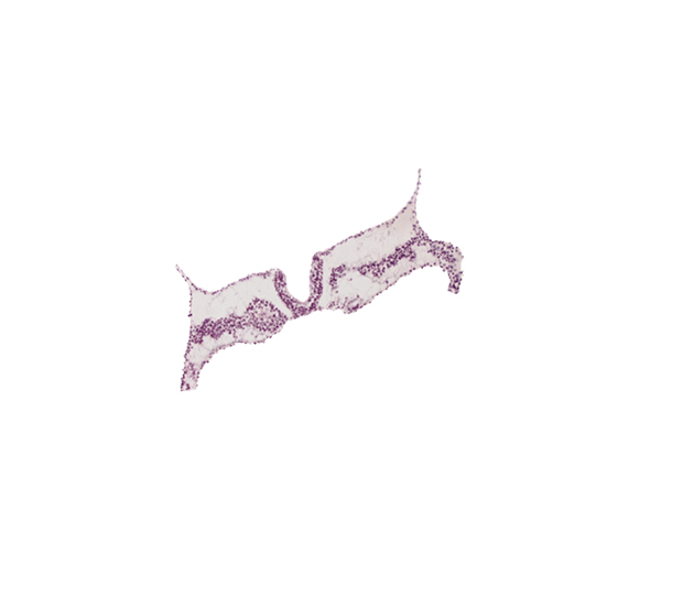 amniotic cavity, caudal edge of somite 2 (O-2), intermediate mesenchyme, lateral plate mesoderm, notochordal plate, primordial left dorsal aorta, rhombomere D (Rh. D), somite 3 (O-3), surface ectoderm