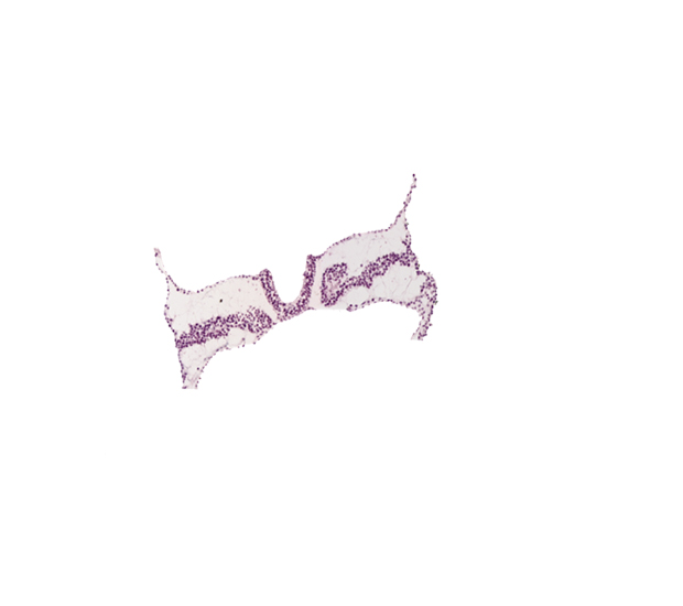 intermediate mesenchyme, midgut primordium (lumen), paraxial mesoderm, separation artifact, somite 4 (O-4)