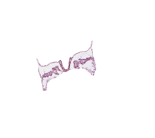 amnion attachment, artifact separation(s), intermediate mesenchyme, midgut primordium (lumen), paraxial mesoderm