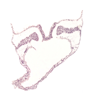 artifact separation(s), caudal intestinal portal, intermediate mesenchyme, lateral plate mesoderm, neural plate, notochordal plate, paraxial mesoderm, spinal cord primordium, umbilical vesicle wall