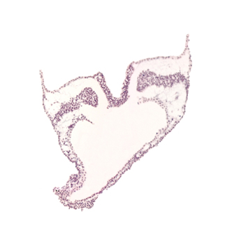 left vitelline (omphalomesenteric) artery, midgut primordium (lumen), primordial left dorsal aorta, spinal cord part of neural plate, spinal cord primordium