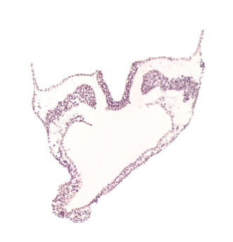 angioblastic tissue, artifact separation(s), caudal part of umbilical vesicle cavity, hindgut primordium (lumen), intermediate mesenchyme, lateral plate mesoderm, paraxial mesoderm