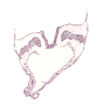 artifact separation(s), caudal part of umbilical vesicle cavity, hindgut primordium (lumen), intermediate mesenchyme, lateral plate mesoderm, paraxial mesoderm