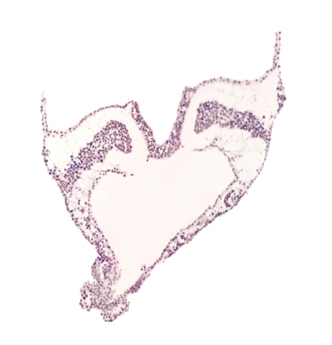 artifact separation(s), ectoderm, endoderm, hindgut primordium (lumen), mesoderm