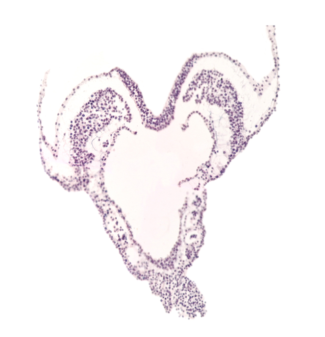 amnion attachment, artifact separation(s), endoderm, hindgut primordium (lumen), left umbilical artery, primordial left dorsal aorta, primordial right dorsal aorta