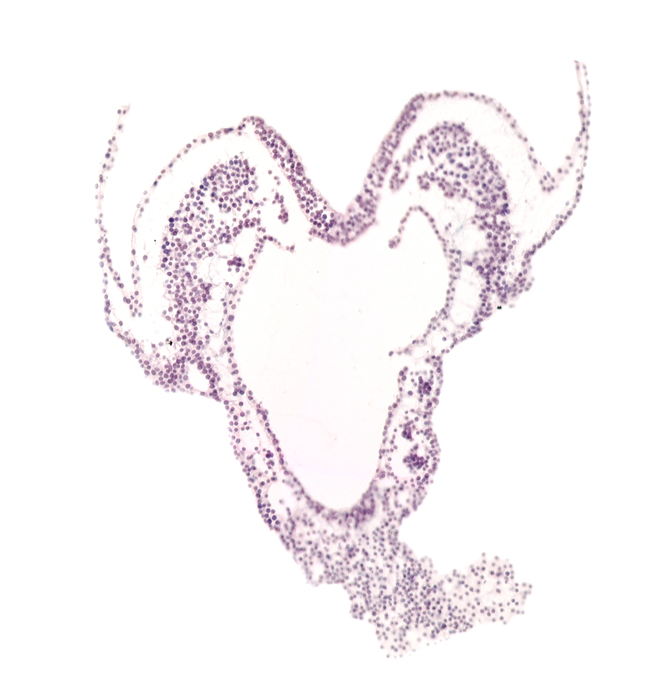hindgut primordium (lumen), left umbilical artery, left vitelline (omphalomesenteric) artery, mesenchyme, primordial right dorsal aorta, right umbilical artery