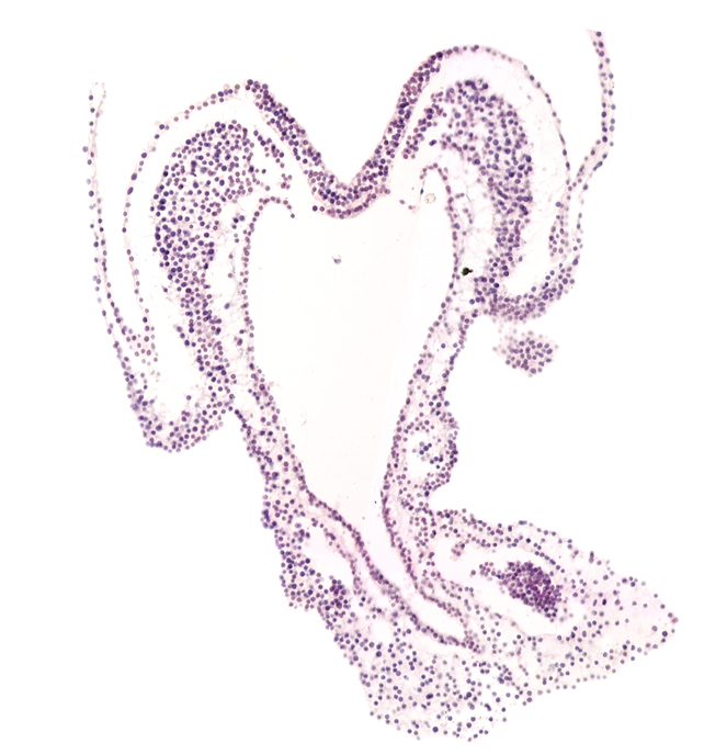 left umbilical artery, neural plate, notochordal plate, paraxial mesoderm, primordial left dorsal aorta, right umbilical artery