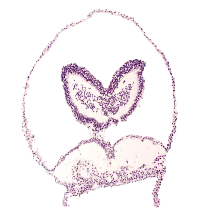 amnion, cephalic edge of primordial pericardial cavity, head fold region, head mesenchyme, left neural fold, prosencephalon primordium (P), right neural fold, terminal notch