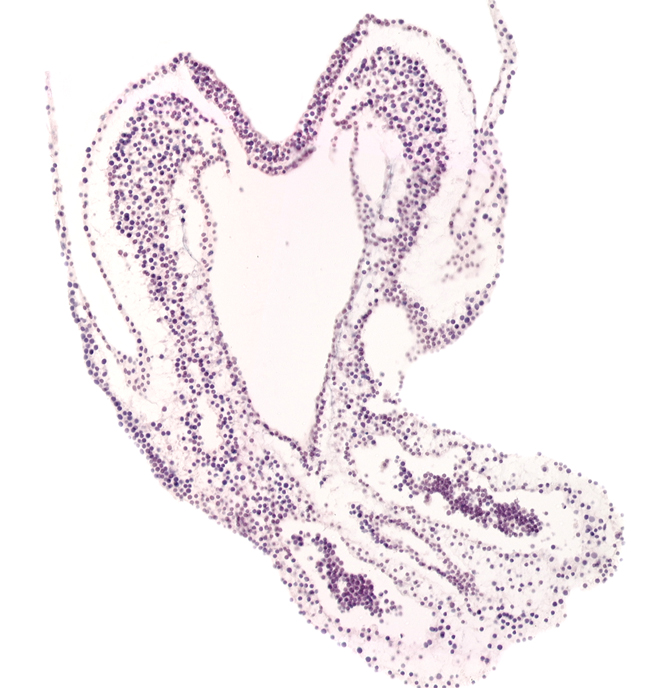 allantoic diverticulum, amnion attachment, connecting stalk, hindgut primordium (lumen), left umbilical artery, notochordal plate, primordial left dorsal aorta, right umbilical artery
