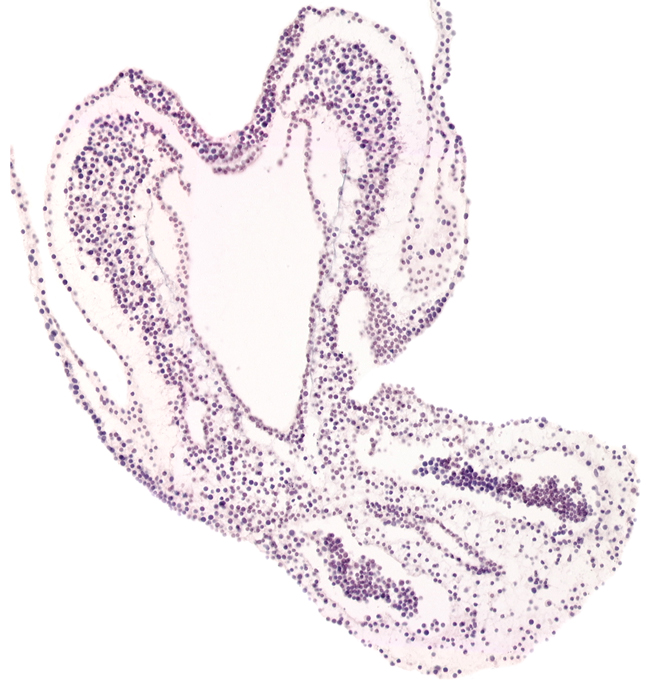 allantoic diverticulum, amniotic cavity, endoderm, hindgut primordium (lumen), left umbilical artery, neural ectoderm, notochordal plate, right umbilical artery, surface ectoderm