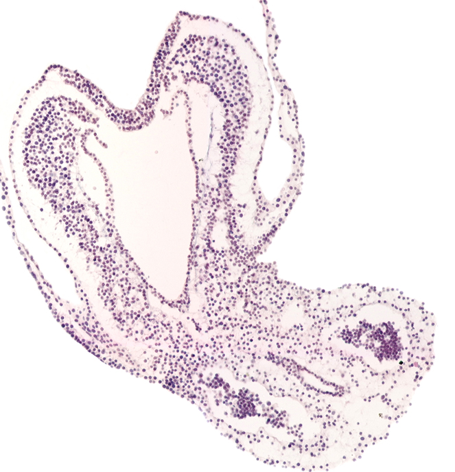 allantoic diverticulum, amniotic cavity, endoderm, hindgut primordium (lumen), left umbilical artery, mesoderm, notochordal plate, right umbilical artery, surface ectoderm