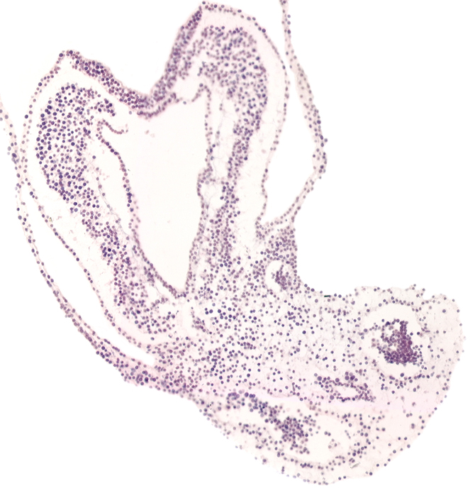 allantoic diverticulum, caudal part of notochordal plate, hindgut primordium (lumen), left umbilical vein, neural plate, right umbilical vein