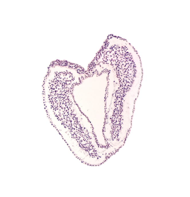 amnion attachment, caudal part of neural plate, connecting stalk, hindgut primordium (lumen), left umbilical vein, notochordal (primitive) pit, right umbilical vein, surface ectoderm, tail fold region, ventral ectodermal ridge