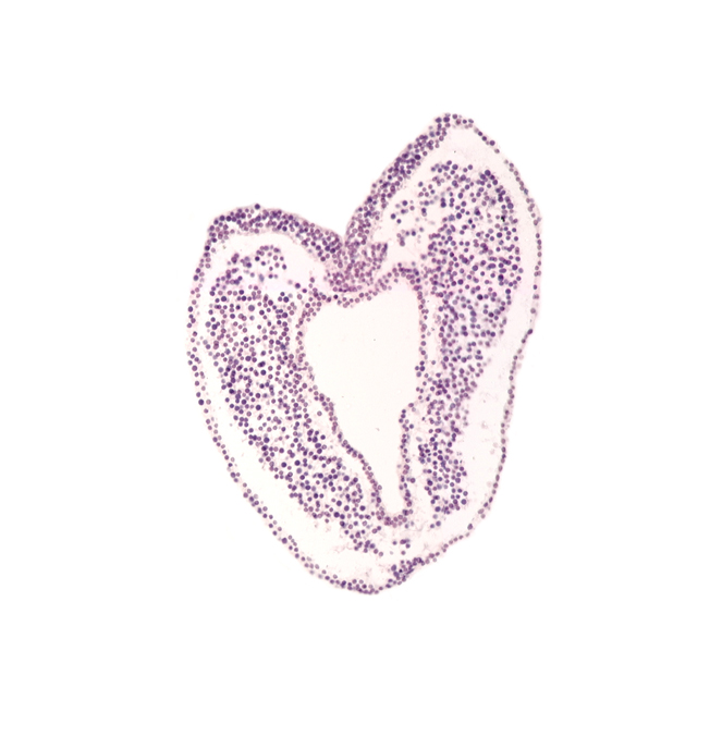 allantois, endoderm, gastrulation (primitive) groove, left umbilical artery, left umbilical vein, mesoderm, neural cord, right umbilical artery, right umbilical vein, surface ectoderm