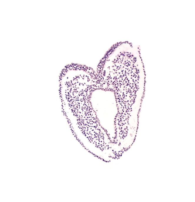 amniotic cavity, artifact separation(s), gastrulation (primitive) groove, gastrulation (primitive) streak, mesoderm, ventral ectodermal ridge