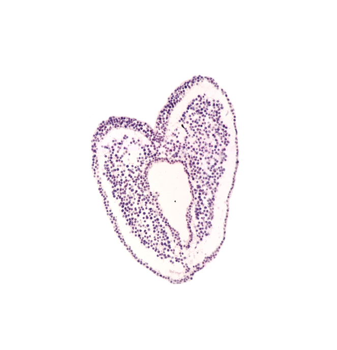 allantoic diverticulum, common umbilical vein, hindgut primordium (lumen), left umbilical artery, right umbilical vein, spinal cord primordium (caudal part)