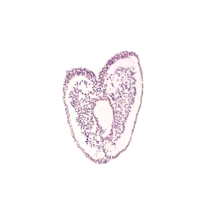 gastrulation (primitive) groove, gastrulation (primitive) streak, mesoderm, ventral ectodermal ridge