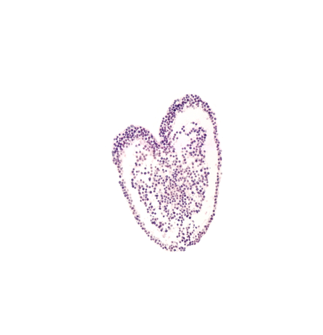 amniotic cavity, caudal edge of hindgut primordium (lumen), common umbilical artery, connecting stalk, gastrulation (primitive) streak, left umbilical vein, right umbilical vein, ventral ectodermal ridge