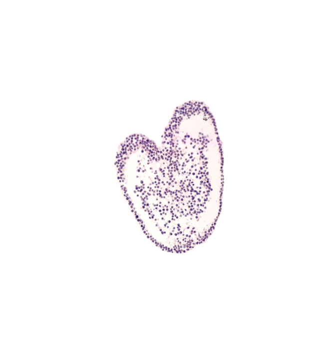 allantoic diverticulum, connecting stalk mesenchyme, mesoderm, neural cord