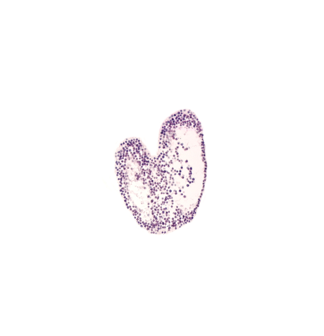 allantoic diverticulum, amnion attachment, amniotic cavity, caudal eminence, connecting stalk, gastrulation (primitive) streak, left umbilical artery, left umbilical vein, neural cord, right umbilical artery, right umbilical vein, ventral ectodermal ridge