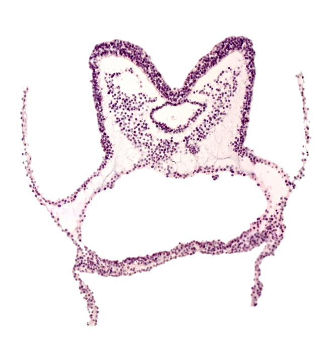 amniotic cavity, aortic arch 1, foregut primordium (lumen), head mesenchyme, neural fold of prosencephalon primordium (P), neural groove, notochordal plate, pharyngeal arch 1, primordial left dorsal aorta, primordial pericardial cavity, primordial right dorsal aorta