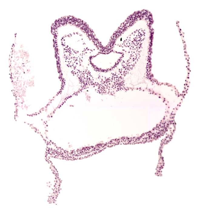 amnion attachment, aortic arch 1, foregut primordium (lumen), neural fold of prosencephalon primordium (P), primordial left dorsal aorta, primordial pericardial cavity, primordial right dorsal aorta