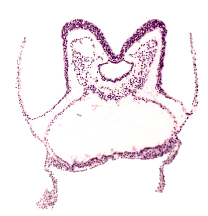 neural fold of prosencephalon primordium (P), neural groove, neural plate, pharyngeal pouch 1, primordial pericardial cavity, surface ectoderm