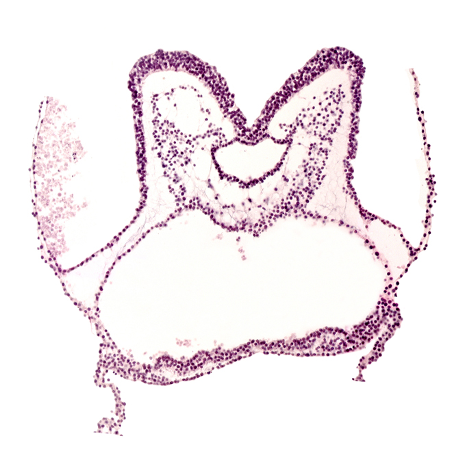 amnion attachment, aortic arch 1, caudal part of prosencephalon primordium (P), notochordal plate, primordial pericardial cavity, umbilical vesicle attachment