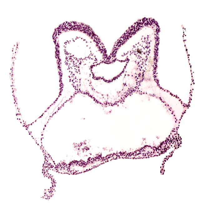 aortic arch 1, cephalic edge of heart primordium, junction of mesencephalon primordium (M) and prosencephalon primordium (P), pharyngeal pouch 1, primordial pericardial cavity