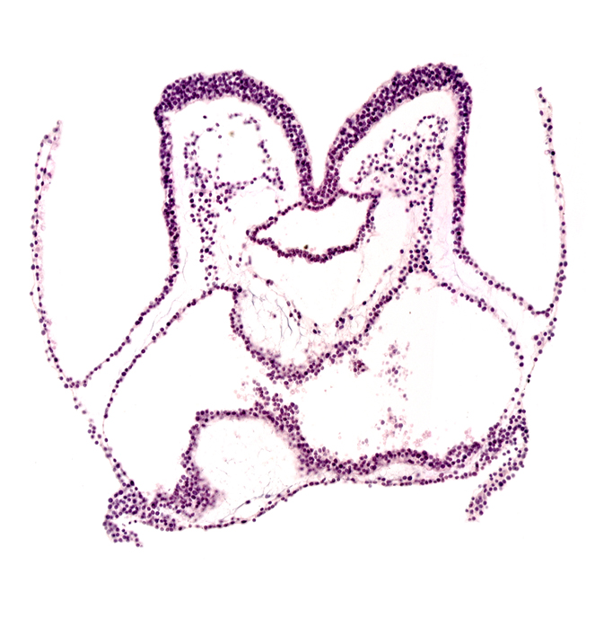 amnion attachment, amniotic cavity, artifact space(s), foregut primordium (lumen), mesencephalon primordium (M), pharyngeal pouch 1, primordial pericardial cavity, region of mesencephalic (cephalic) flexure, umbilical vesicle cavity