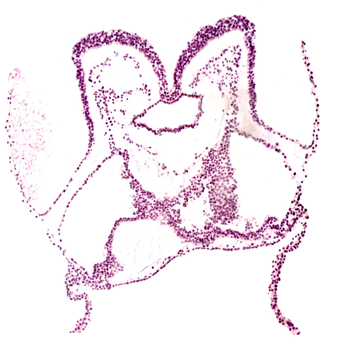 aortic arch 2, cardiac jelly, foregut primordium (lumen), head mesenchyme, mesencephalon primordium (M), notochordal plate, primordial epimyocardium, primordial myocardium, primordial pericardial cavity