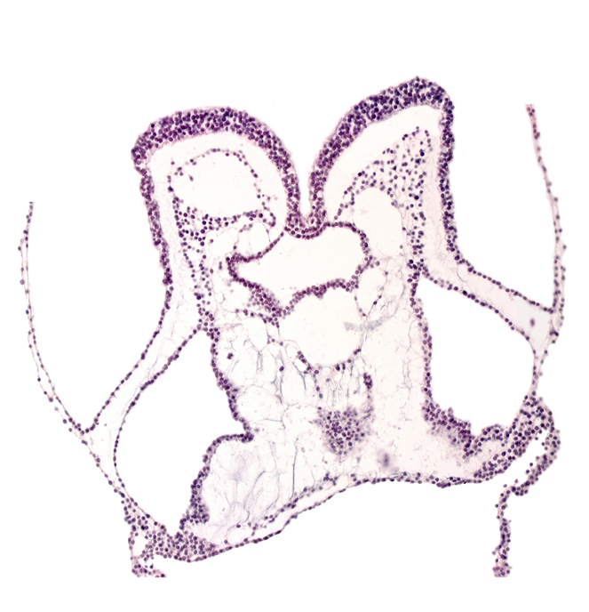 amnion attachment, amniotic cavity, aortic arch 2, cardiac jelly, foregut primordium (lumen), mesencephalon primordium (M), primordial endocardium in midline, primordial left dorsal aorta, primordial pericardial cavity, somatopleuric mesoderm, splanchnopleuric mesoderm (epimyocardium)