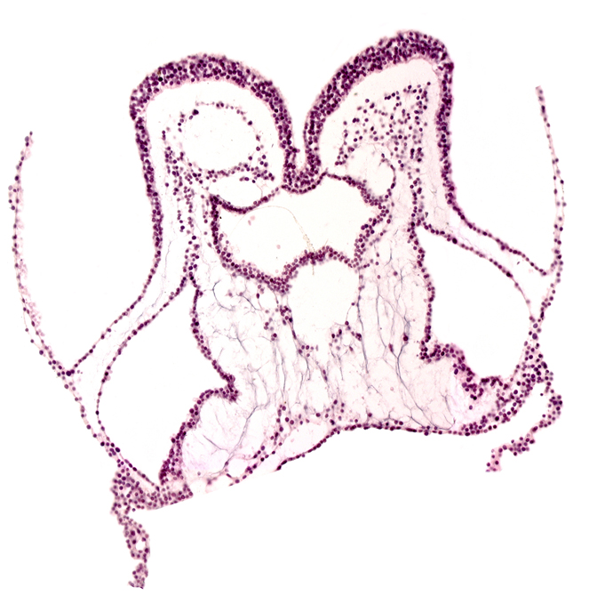 amnion attachment, amniotic cavity, artifact separation(s), foregut primordium (lumen), interventricular sulcus, mesencephalon primordium (M), pharyngeal pouch 2, presumptive left ventricle, presumptive right ventricle, primordial left dorsal aorta, primordial neural crest (artifact separation), umbilical vesicle cavity, umbilical vesicle wall
