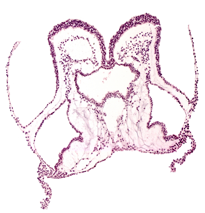 mesencephalon primordium (M), notochordal plate