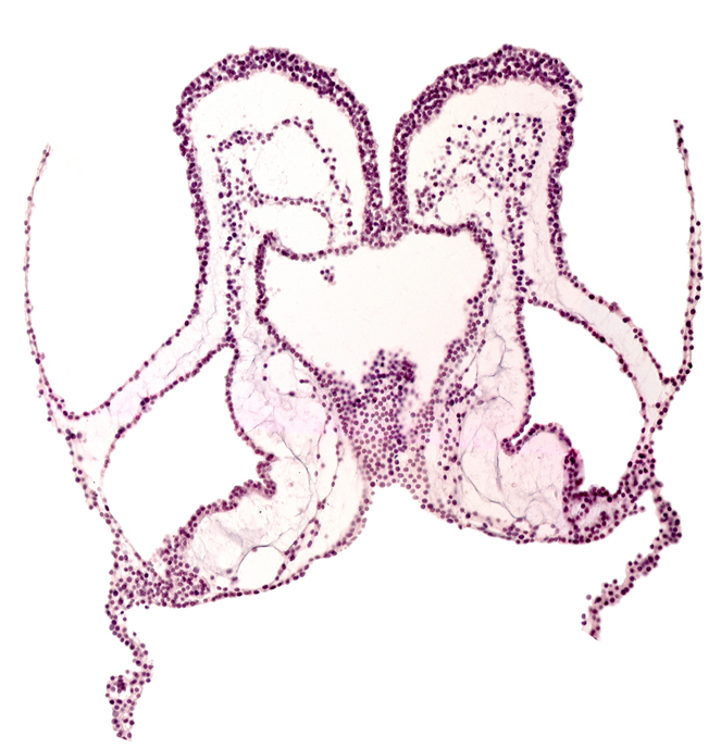 aortic arch 3, cephalic intestinal portal, head mesenchyme, hepatic plate endoderm, interventricular sulcus, mesencephalon primordium (M), primordial endocardium, primordial left dorsal aorta, primordial pericardial cavity