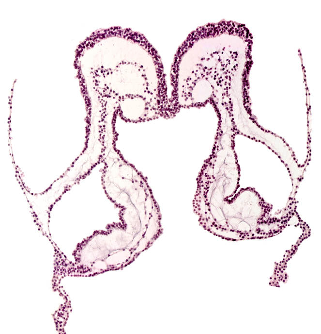 aortic arch 3, conotruncus, endoderm, head mesenchyme, interventricular sulcus, midgut primordium (lumen), neural fold, notochordal plate, presumptive left ventricle, presumptive right ventricle, primordial left dorsal aorta, primordial right dorsal aorta, umbilical vesicle cavity