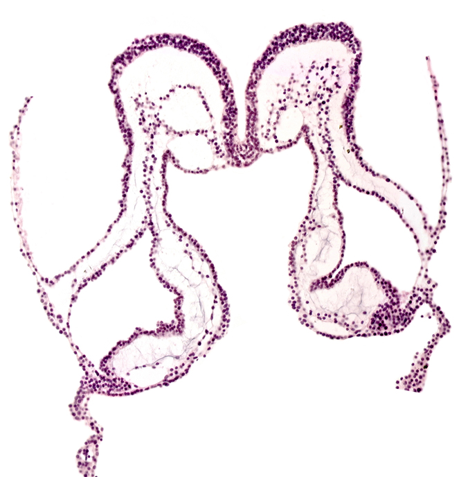 conotruncus, mesencephalon primordium (M), notochordal plate, primordial epimyocardium, primordial left dorsal aorta, primordial pericardial cavity