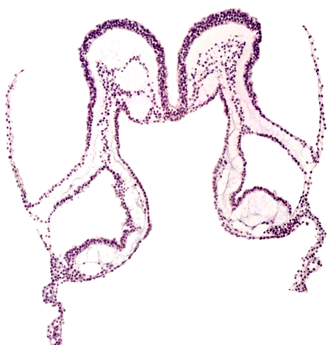 amniotic cavity, extra-embryonic endoderm, extra-embryonic mesoderm, mesencephalon primordium (M), midgut primordium (lumen), primordial left dorsal aorta, primordial pericardial cavity, umbilical vesicle angioblastic tissue, umbilical vesicle cavity