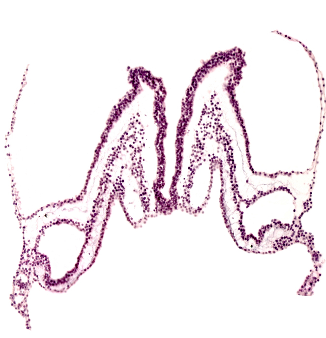 amnion attachment, midgut primordium (lumen), primordial right dorsal aorta, umbilical vesicle wall