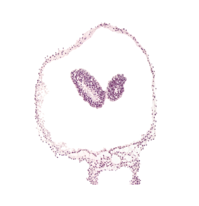amnion, amniotic cavity, artifact space(s), left neural fold, neural groove, prosencephalon primordium (P), right neural fold, umbilical vesicle cavity, umbilical vesicle wall