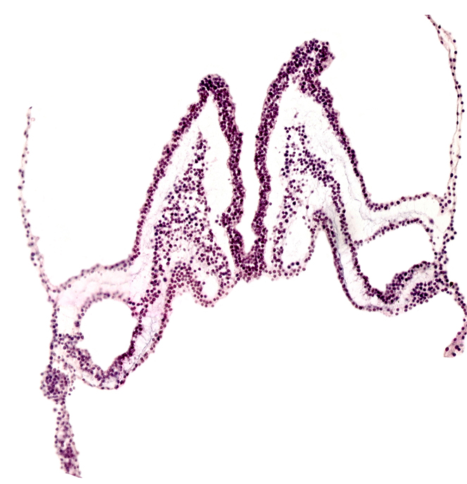 angioblastic tissue, head mesenchyme, primordial left dorsal aorta, rhombencephalon primordium (R), rhombomere B (Rh. B), rhombomere C (Rh. C), umbilical vesicle attachment